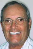 Dental Patient, Smiles, Dr. Evan DDS, Dental Implants