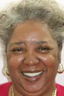 Dental Patient, Smiles, Dr. Evan DDS, Dental Implants